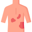 Acne Scars Specialist in Faridabad